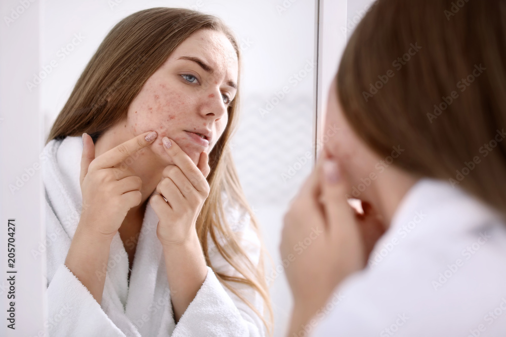 Young woman with acne problem near mirror in bathroom Young woman with acne problem near mirror in bathroom