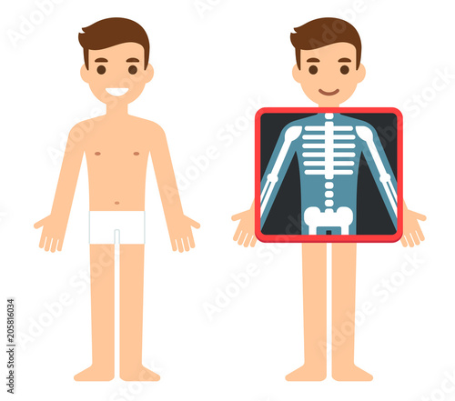 Cartoon Xray character