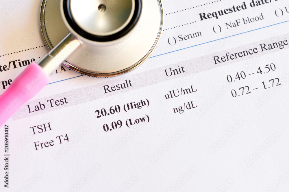 Abnormal thyroid hormone test result with stethoscope, blood sample