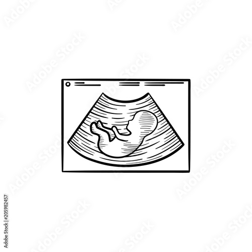 Fetal ultrasound hand drawn outline doodle icon. Pregnancy sonogram of a baby in womb vector sketch illustration for print, web, mobile and infographics isolated on white background.