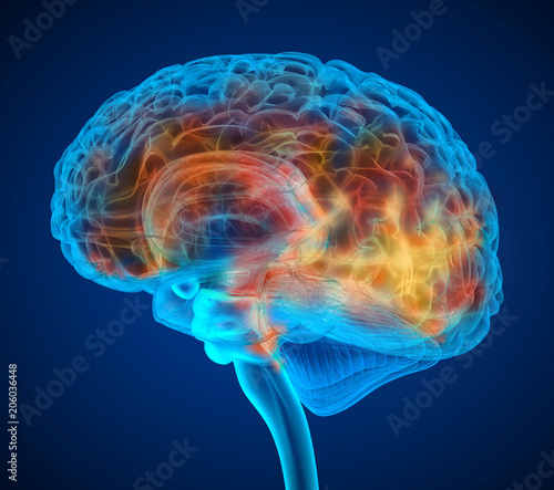 Fototapeta Naklejka Na Ścianę i Meble -  Human brain tumor X-ray scan , Medically accurate 3D illustration