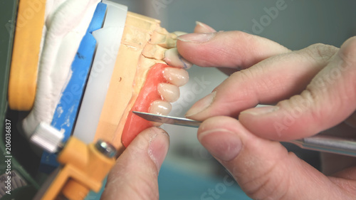 Lab technician removing imperfections from dental implant