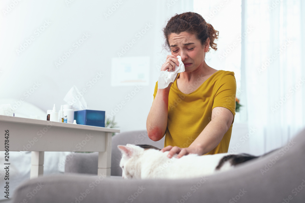 Cat is to blame. Young miserably looking woman cat owner suffering from runny nose as a result of cats fur allergy Cat is to blame. Young miserably looking woman cat owner suffering from runny nose as a result of cats fur allergy