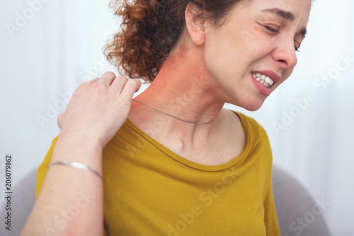 Fake silver. Young woman customer suffering from a skin soreness looking discomforted from wearing a newly bought fake silver necklace causing her body have an allergic response in a form of a rash © zinkevych