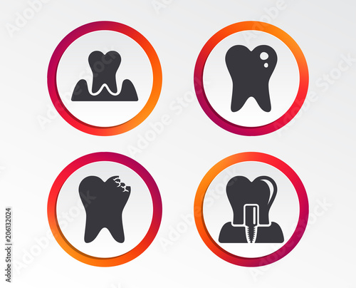 Dental care icons. Caries tooth sign. Tooth endosseous implant symbol. Parodontosis gingivitis sign. Infographic design buttons. Circle templates. Vector