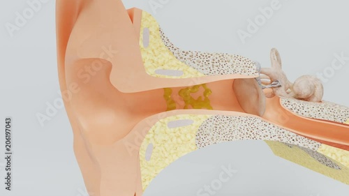 Ear wax self-cleaning during chewing. Model of the inner ear.