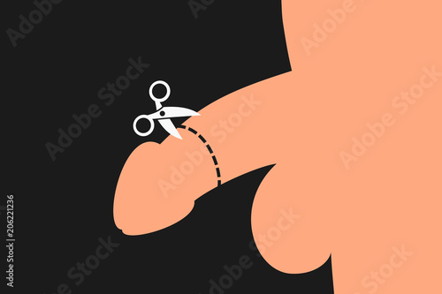 Male circumcision - surgical removal of the foreskin on the penis of man. Skin is cutted by scissors from sex organ. Traditional, religious, cultural and medical surgical procedure.