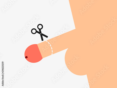 Male circumcision - surgical removal of the foreskin on the penis of man. Skin is cutted by scissors from sex organ. Traditional, religious, cultural and medical surgical procedure.