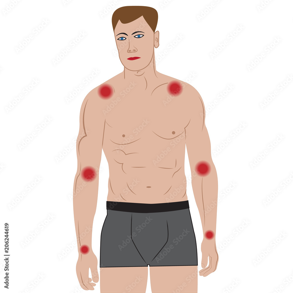 Joint pain in arms from infected or injury male body Joint pain in arms from infected or injury male body