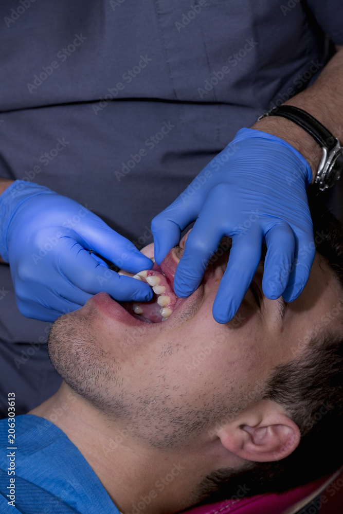 Young man at the dentist, to perform a dental implant