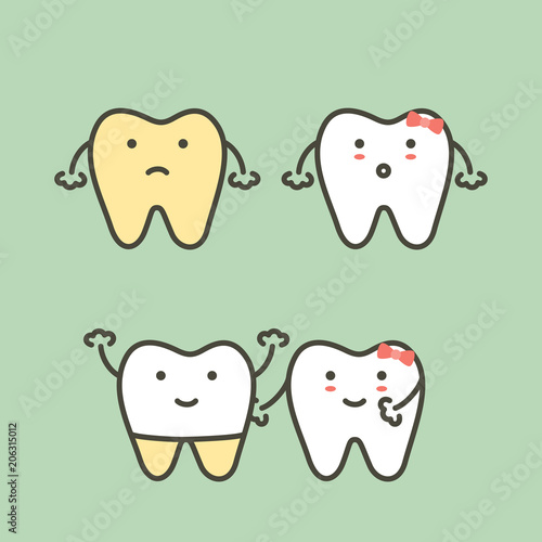 step of dental veneers - tooth whitening, yellow to white tooth before and after