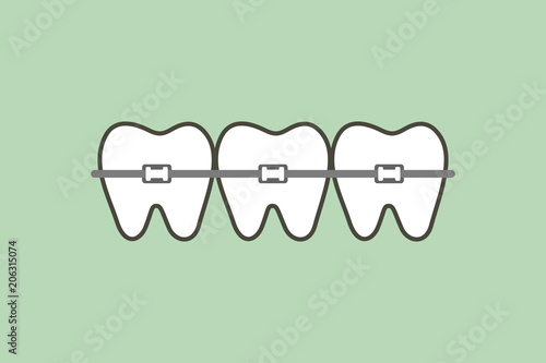 orthodontic teeth or dental braces