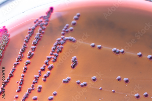 Colony Characteristics of Escherichia coli (E. coli) is a Gram-negative, facultatively anaerobic, rod-shaped, coliform bacterium of the genus Escherichia that is commonly found in the lower intestine. photo