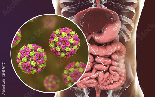 Norovirus in human intestine, also called winter vomiting bug, RNA virus from Caliciviridae family, causative agent of gastroenteritis with diarrhea, vomiting, stomach pain. 3D illustration photo