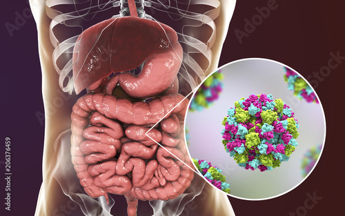 Norovirus in human intestine, also called winter vomiting bug, RNA virus from Caliciviridae family, causative agent of gastroenteritis with diarrhea, vomiting, stomach pain. 3D illustration