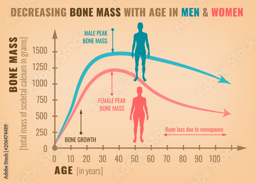Decreasing bone mass 