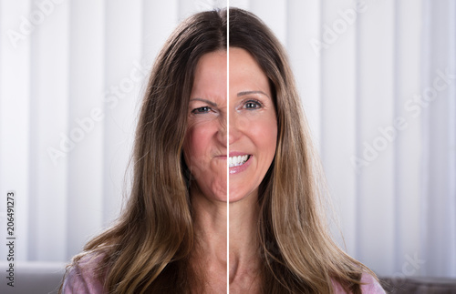 Woman's Split Face With Happy And Sad Emotion
