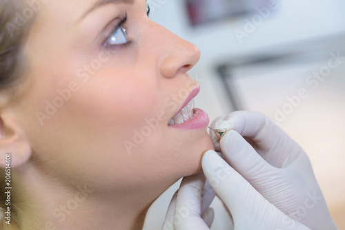Obraz w ramie lip augmentation