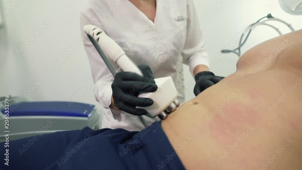 A close-up of the doctor, the cosmetologist in gloves, leads the device for RF-lifting on the belly of the client of the cosmetology clinic. The procedure for carrying out radiofrequency lifting. Rid A close-up of the doctor, the cosmetologist in gloves, leads the device for RF-lifting on the belly of the client of the cosmetology clinic. The procedure for carrying out radiofrequency lifting. Rid