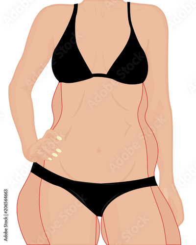 Correction woman figure. Get slim. Liposuction Vector illustration 