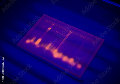 Close-up of a gel with DNA after electrophoresis. Results of electrophoresis after PCR. photo