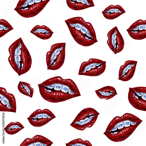 Illustration with lips and braces. Seamless pattern on white background.