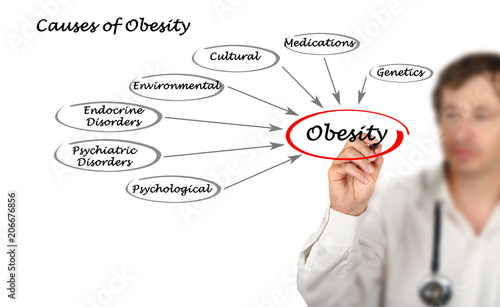 Causes of Obesity