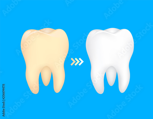 Tooth before and after. Yellow becomes white, Dental care concept,  illustration isolated on blue background.