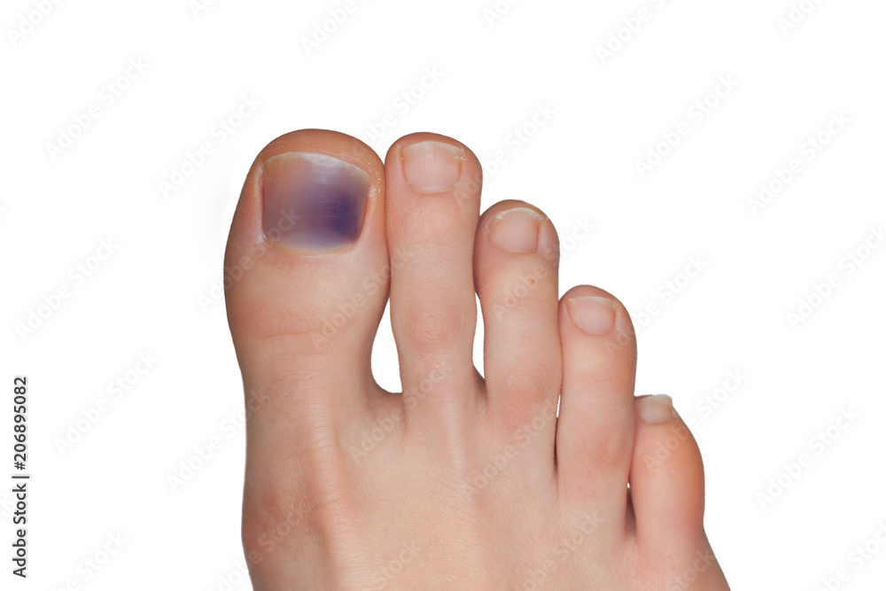 Blue toenail of a young woman isolated on white backgroun Stock