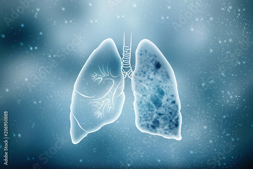 2d illustration Tuberculosis Day photo