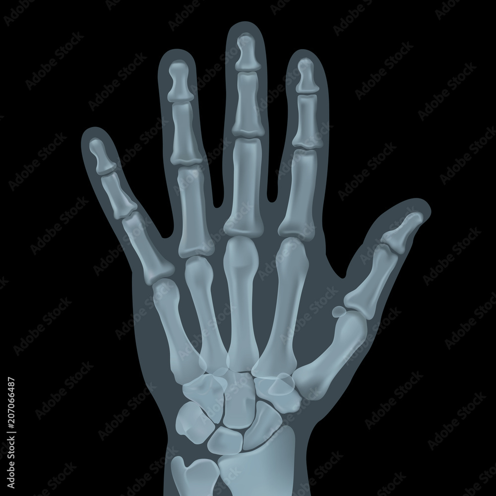 Realistic x-ray shots.Image uses a grid gradient. Realistic x-ray shots.Image uses a grid gradient.