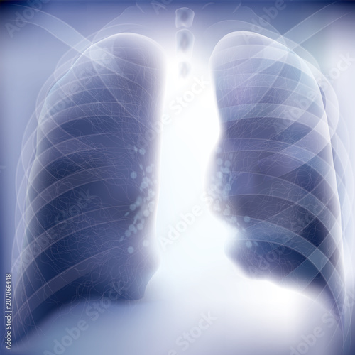 Chest image,Realistic x-ray shots.Image uses layer overlay effects.