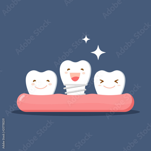 Vector cartoon white teeth happy with denture or Dental implant. Restoration in the oral cavity. Flat illustration on the theme of dentistry. Isolated vector.