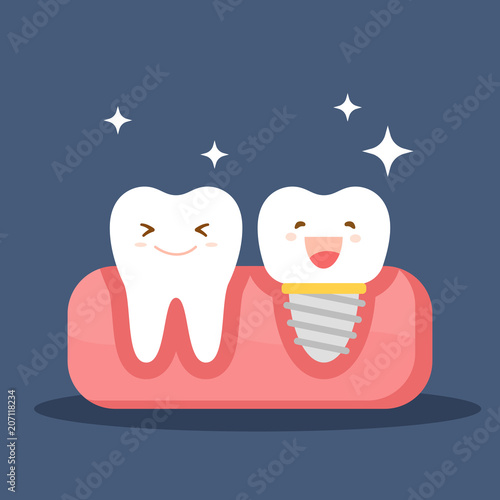 Dental implant and a normal tooth. Restoration in the oral cavity. Flat illustration on the theme of dentistry. Vector illustration isolated on blue background.