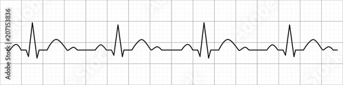 Heartbeat line. Cardiogram. Electrocardiogram. Vector illustration.