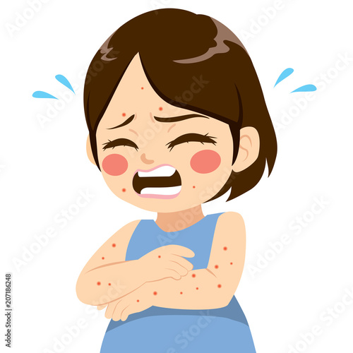 Cute little girl with small itchy blisters symptom ill with measles chickenpox illness