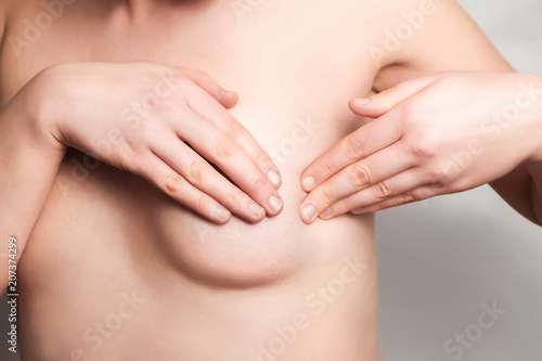 Breast Self-Exam (BSE)