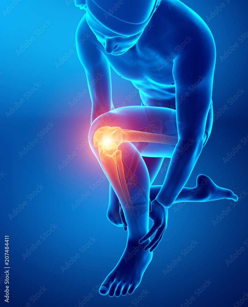 Male Knee pain Male Knee pain