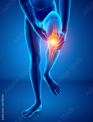 Male Knee pain