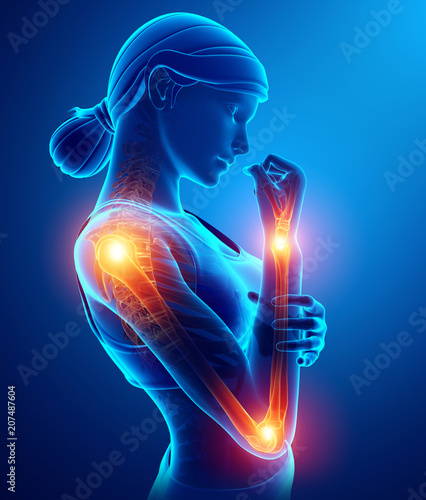 Women Feeling Arm joint pain