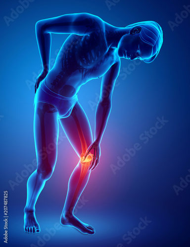 Male Knee pain