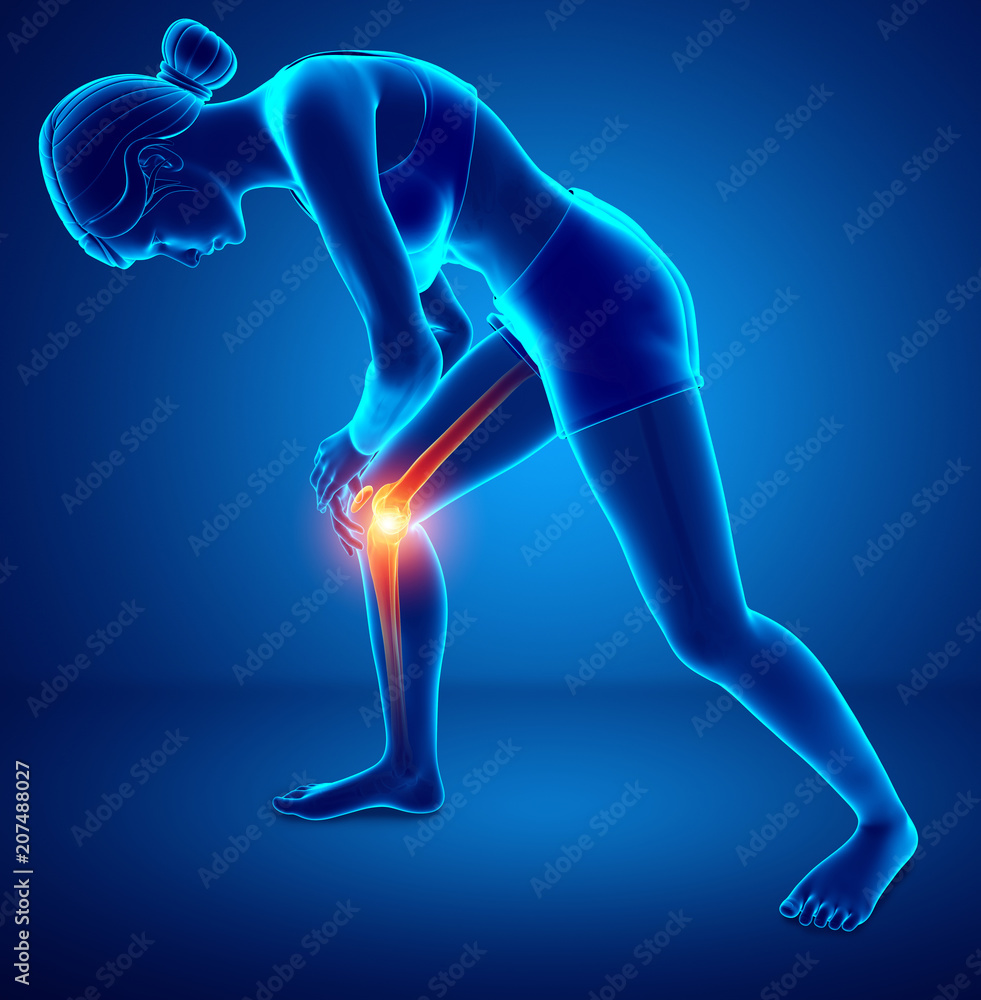 Women Knee joint pain
