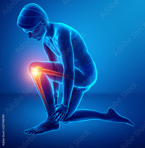 Male Knee pain