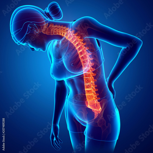 Women Feeling the Back pain