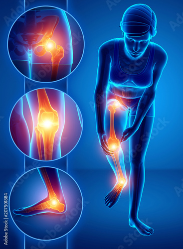 3d Illustration of Female feeling Leg pain