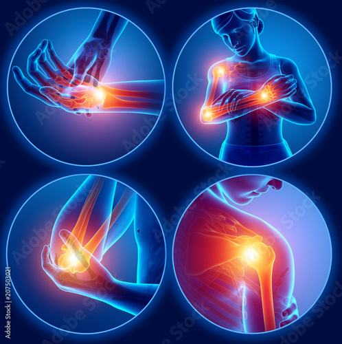 3d Illustration of Female Feeling Arm joint pain photo