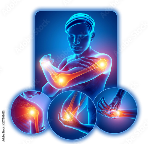 3d Illustration of Men Feeling Arm joint pain