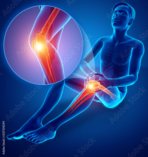 3d Illustration of Male feeling Knee pain
