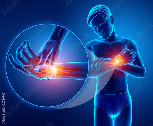 3d Illustration of men Feeling wrist pain