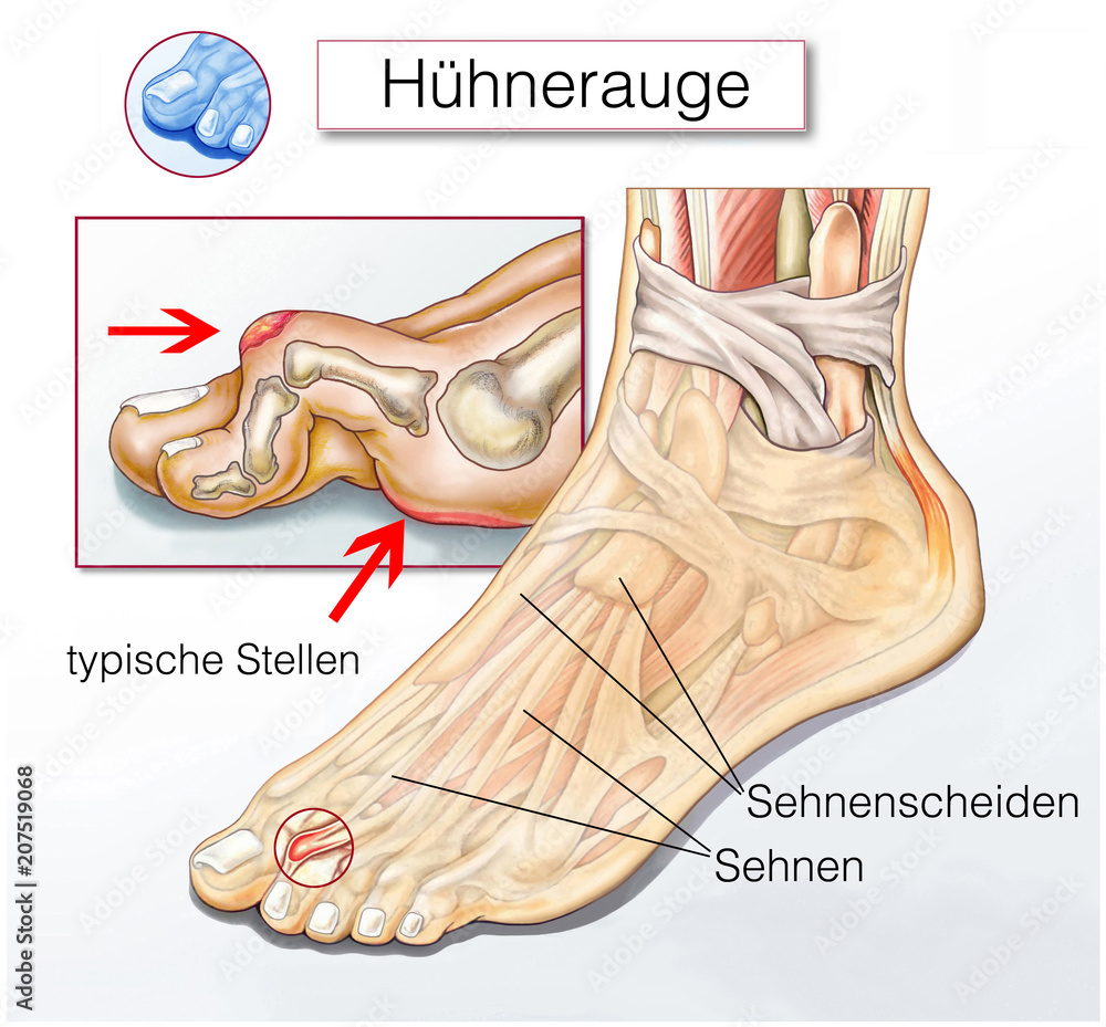 H hnerauge Stock Illustration Adobe Stock H hnerauge Stock Illustration Adobe Stock